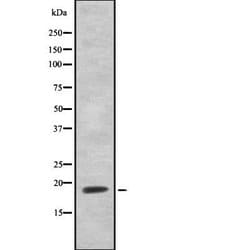 Invitrogen HEN1/HEN2 Polyclonal Antibody 100 &mu;L; Unconjugated:Antibodies,