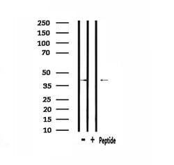 Invitrogen HORMAD1 Polyclonal Antibody 100 &mu;L; Unconjugated:Antibodies,