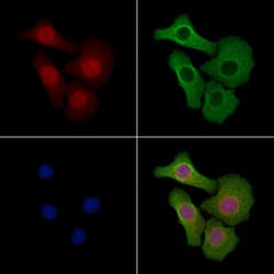 Invitrogen HOXD10 Polyclonal Antibody 100 &mu;L; Unconjugated:Antibodies,