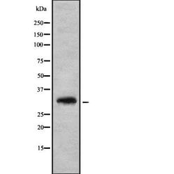 Invitrogen HOXD8 Polyclonal Antibody 100 &mu;L; Unconjugated:Antibodies,