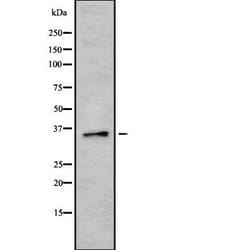 Invitrogen HEY2 Polyclonal Antibody 100 &mu;L; Unconjugated:Antibodies,