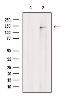 Invitrogen KCNT1 Polyclonal Antibody 100 &mu;L; Unconjugated:Antibodies,