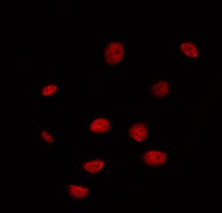Invitrogen DUSP4 Polyclonal Antibody 100 &mu;L; Unconjugated:Antibodies,