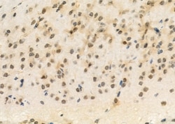Invitrogen DUSP4 Polyclonal Antibody 100 &mu;L; Unconjugated:Antibodies,