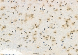 Invitrogen DUSP4 Polyclonal Antibody 100 &mu;L; Unconjugated:Antibodies,
