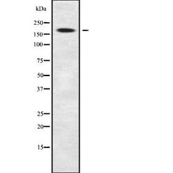 Invitrogen MRCK beta Polyclonal Antibody 100 &mu;L | Buy Online | Invitrogen&trade; | Fisher Scientific