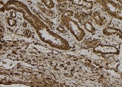 Invitrogen NRIP3 Polyclonal Antibody 100 &mu;L; Unconjugated:Antibodies,