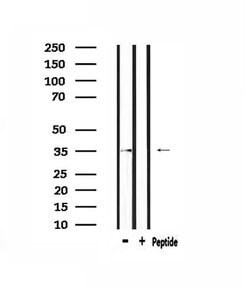 Invitrogen OR5AP2 Polyclonal Antibody 100 &mu;L; Unconjugated:Antibodies,