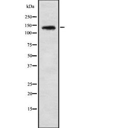 Invitrogen PHKA1/PHKA2 Polyclonal Antibody 100 &mu;L; Unconjugated:Antibodies,