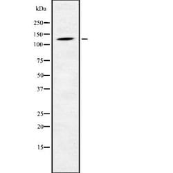 Invitrogen PHKB Polyclonal Antibody 100 &mu;L; Unconjugated:Antibodies,