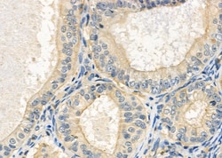 Invitrogen OLFML2B Polyclonal Antibody 100 &mu;L; Unconjugated:Antibodies,