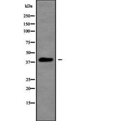 Invitrogen PKA alpha/beta/gamma Polyclonal Antibody 100 &mu;L; Unconjugated:Antibodies,