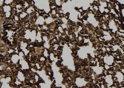 Invitrogen A26C2/A26C3 Polyclonal Antibody 100 &mu;L; Unconjugated:Antibodies,
