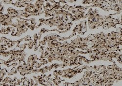 Invitrogen PSKH1 Polyclonal Antibody 100 &mu;L; Unconjugated:Antibodies,