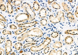 RhoG Polyclonal Antibody 100 &mu;L | Buy Online | Thermo Scientific | Fisher Scientific