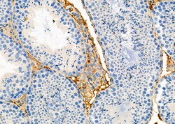 RhoG Polyclonal Antibody 100 &mu;L | Buy Online | Thermo Scientific | Fisher Scientific