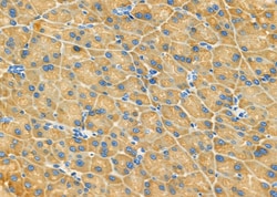 RhoG Polyclonal Antibody 100 &mu;L | Buy Online | Thermo Scientific | Fisher Scientific