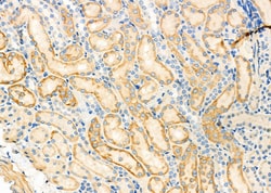 RhoG Polyclonal Antibody 100 &mu;L | Buy Online | Thermo Scientific | Fisher Scientific