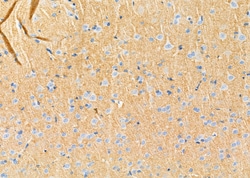 RhoG Polyclonal Antibody 100 &mu;L | Buy Online | Thermo Scientific | Fisher Scientific