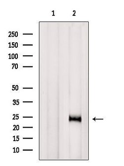 RhoG Polyclonal Antibody 100 &mu;L | Buy Online | Thermo Scientific | Fisher Scientific