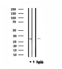 Invitrogen RPS2 Polyclonal Antibody 100 &mu;L; Unconjugated:Antibodies,