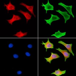Invitrogen RSK4 Polyclonal Antibody 100 &mu;L; Unconjugated:Antibodies,
