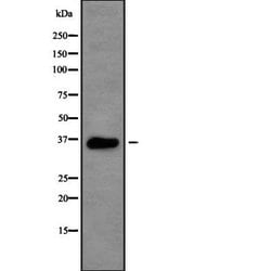 Invitrogen RSU1 Polyclonal Antibody 100 &mu;L | Buy Online | Invitrogen&trade; | Fisher Scientific