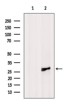Invitrogen SH3BGR Polyclonal Antibody 100 &mu;L | Buy Online | Invitrogen&trade; | Fisher Scientific