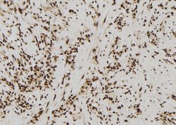 Invitrogen SIN3B Polyclonal Antibody 100 &mu;L; Unconjugated:Antibodies,
