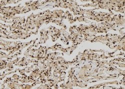 Invitrogen ZNF280A Polyclonal Antibody 100 &mu;L; Unconjugated:Antibodies,