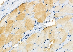 Invitrogen TAUT Polyclonal Antibody 100 &mu;L | Buy Online | Invitrogen&trade; | Fisher Scientific