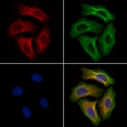 Invitrogen EVER2 Polyclonal Antibody 100 &mu;L; Unconjugated:Antibodies,
