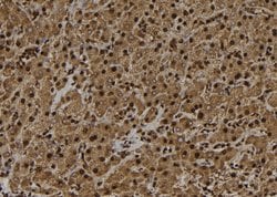 Invitrogen UBE3B Polyclonal Antibody 100 &mu;L; Unconjugated:Antibodies,