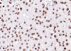 Invitrogen USP36 Polyclonal Antibody 100 &mu;L; Unconjugated:Antibodies,