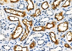 Invitrogen USP36 Polyclonal Antibody 100 &mu;L; Unconjugated:Antibodies,