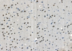 Invitrogen USP36 Polyclonal Antibody 100 &mu;L; Unconjugated:Antibodies,