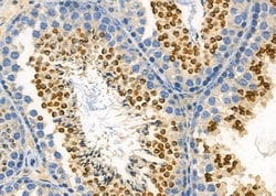 Invitrogen USP40 Polyclonal Antibody 100 &mu;L | Buy Online | Invitrogen&trade; | Fisher Scientific