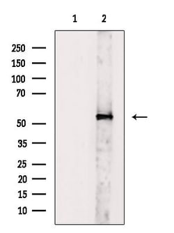 Invitrogen V-ATPase H Polyclonal Antibody 100 &mu;L; Unconjugated:Antibodies,