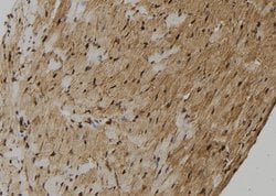 Invitrogen ZMYM4 Polyclonal Antibody 100 &mu;L; Unconjugated:Antibodies,