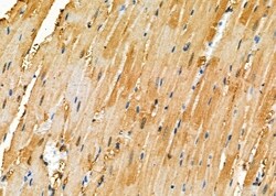 Invitrogen ZMYM4 Polyclonal Antibody 100 &mu;L; Unconjugated:Antibodies,