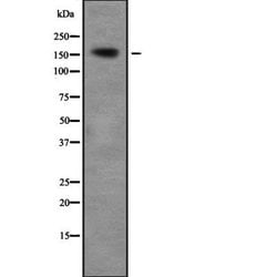 Invitrogen ZNF608 Polyclonal Antibody 100 &mu;L | Buy Online | Invitrogen&trade; | Fisher Scientific