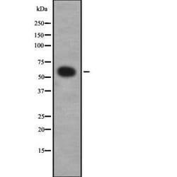 Invitrogen CSGALNACT1 Polyclonal Antibody 100 &mu;L; Unconjugated:Antibodies,
