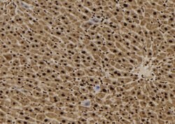 Invitrogen SFT2D3 Polyclonal Antibody 100 &mu;L | Buy Online | Invitrogen&trade; | Fisher Scientific