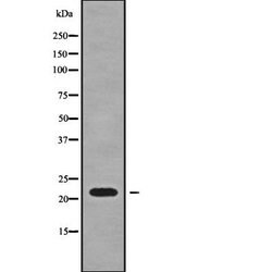 Invitrogen SFT2D3 Polyclonal Antibody 100 &mu;L | Buy Online | Invitrogen&trade; | Fisher Scientific