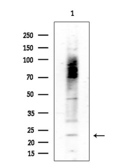 Invitrogen SFT2D3 Polyclonal Antibody 100 &mu;L | Buy Online | Invitrogen&trade; | Fisher Scientific