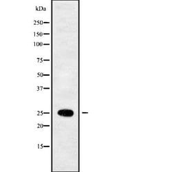Invitrogen SEC22B Polyclonal Antibody 100 &mu;L; Unconjugated:Antibodies,