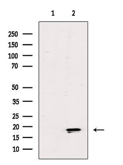 Invitrogen ZNHIT1 Polyclonal Antibody 100 &mu;L; Unconjugated:Antibodies,