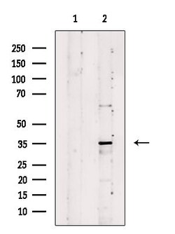 Invitrogen MAGEA6 Polyclonal Antibody 100 &mu;L; Unconjugated:Antibodies,