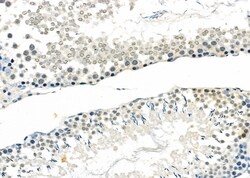 Invitrogen MAGEB3 Polyclonal Antibody 100 &mu;L; Unconjugated:Antibodies,