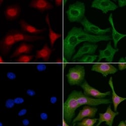 Invitrogen MAGEB6 Polyclonal Antibody 100 &mu;L; Unconjugated:Antibodies,